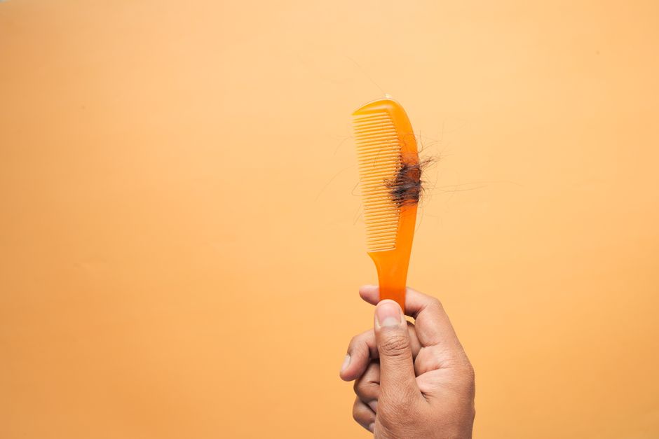 Illustration related to hair loss